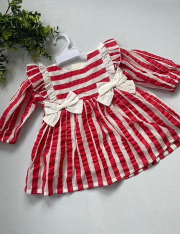 Striped frock